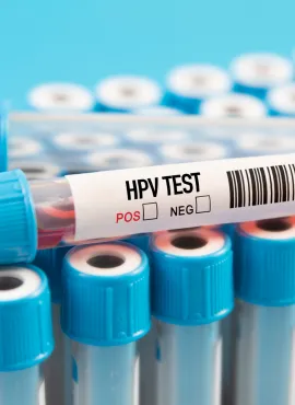 Prueba de PCR para VPH Prueba de PCR para VPH slp